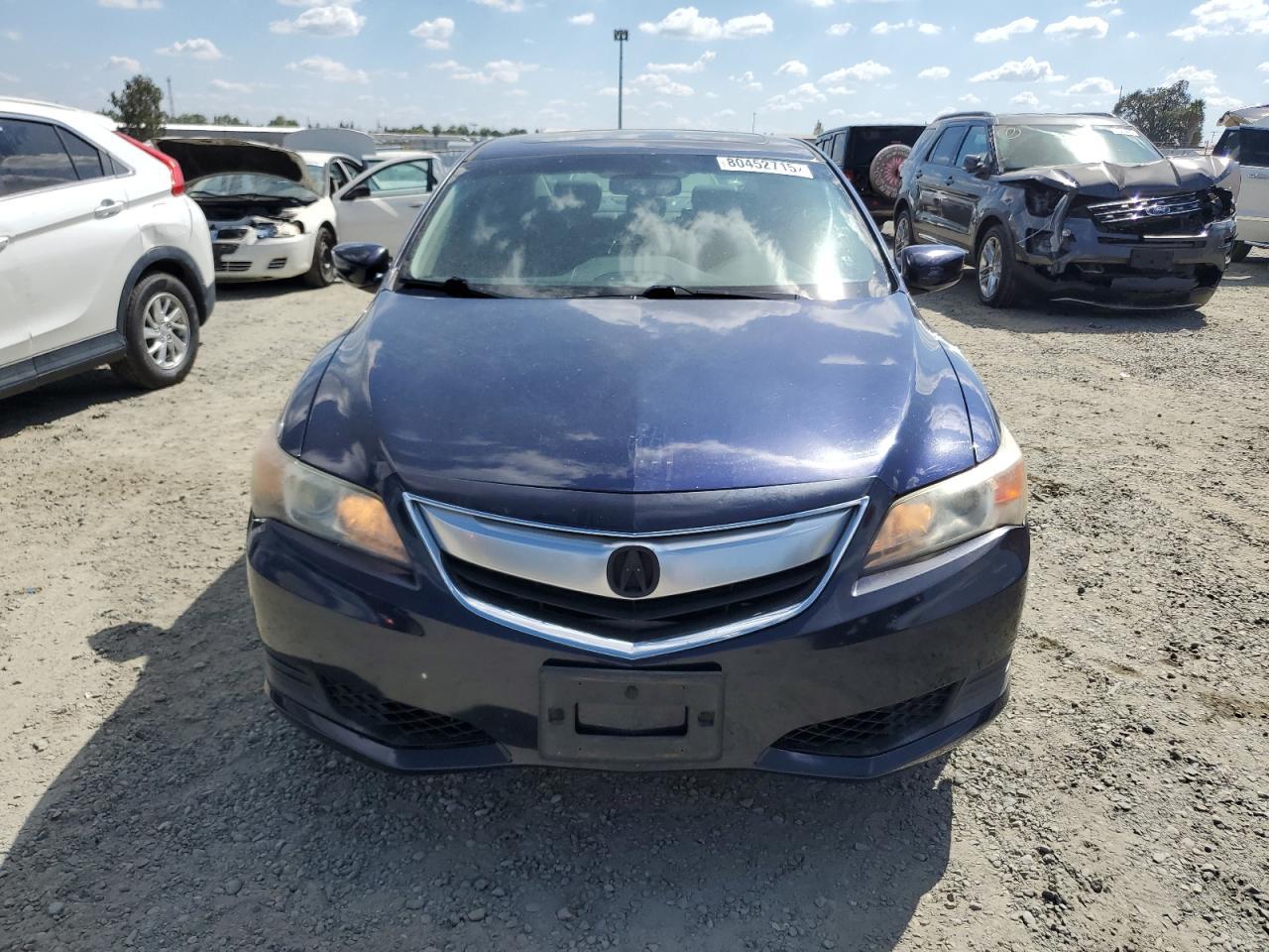 2015 Acura ILX, 20