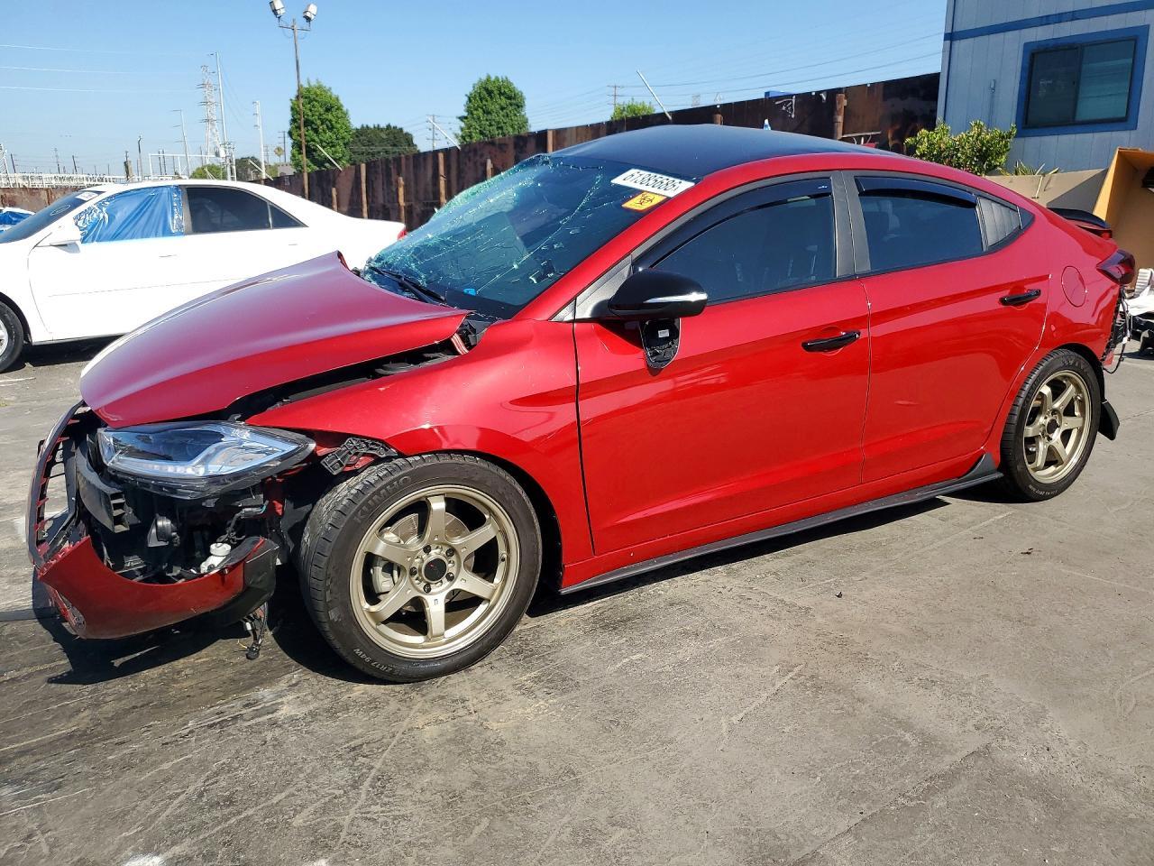 2017 Hyundai Elantra, Limited