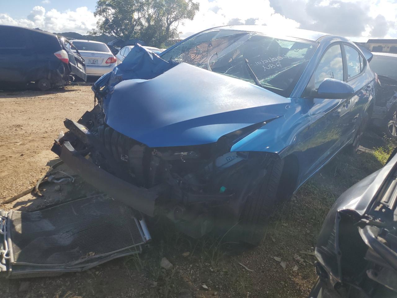 2017 Hyundai Elantra, SE
