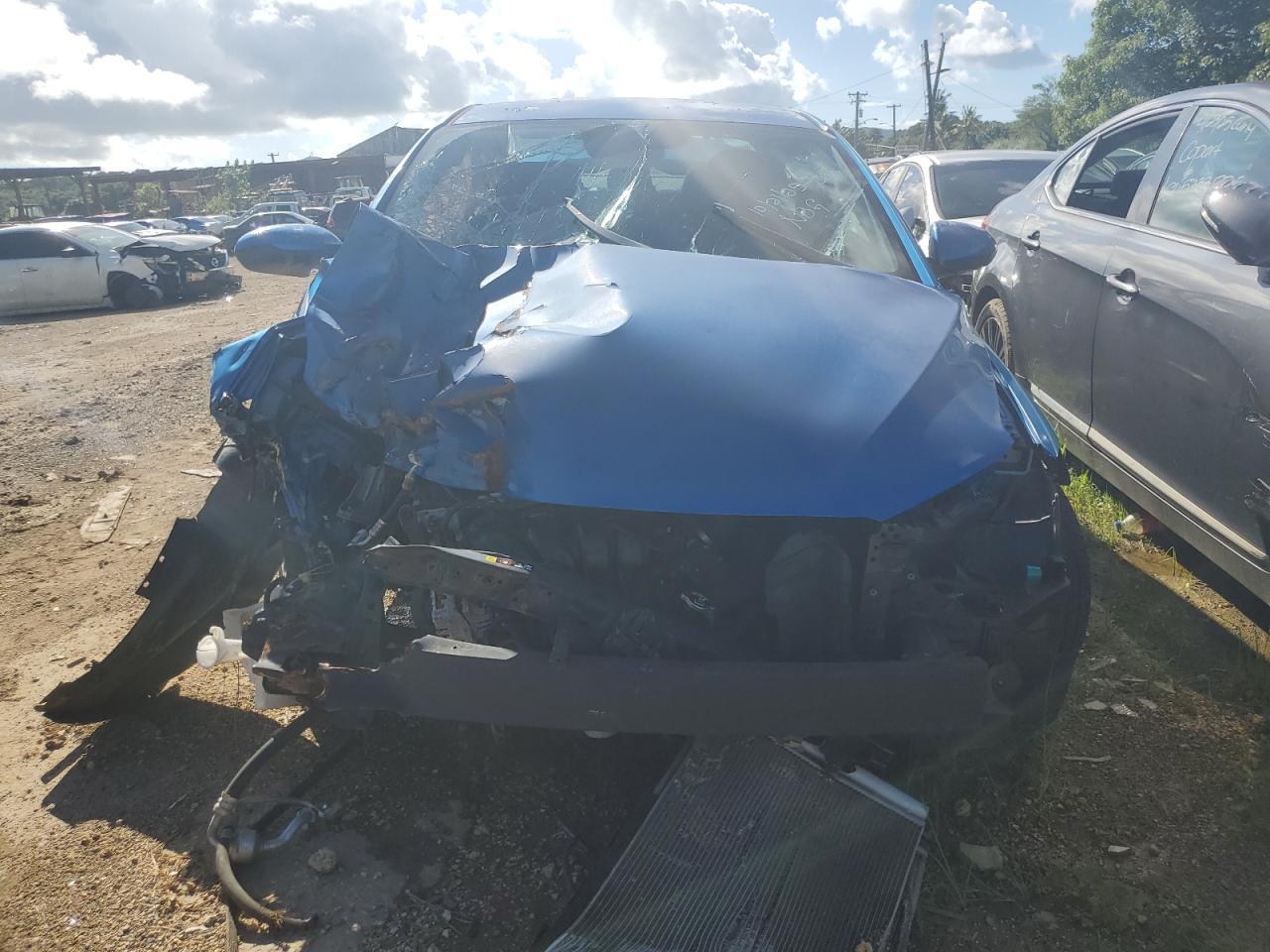 2017 Hyundai Elantra, SE