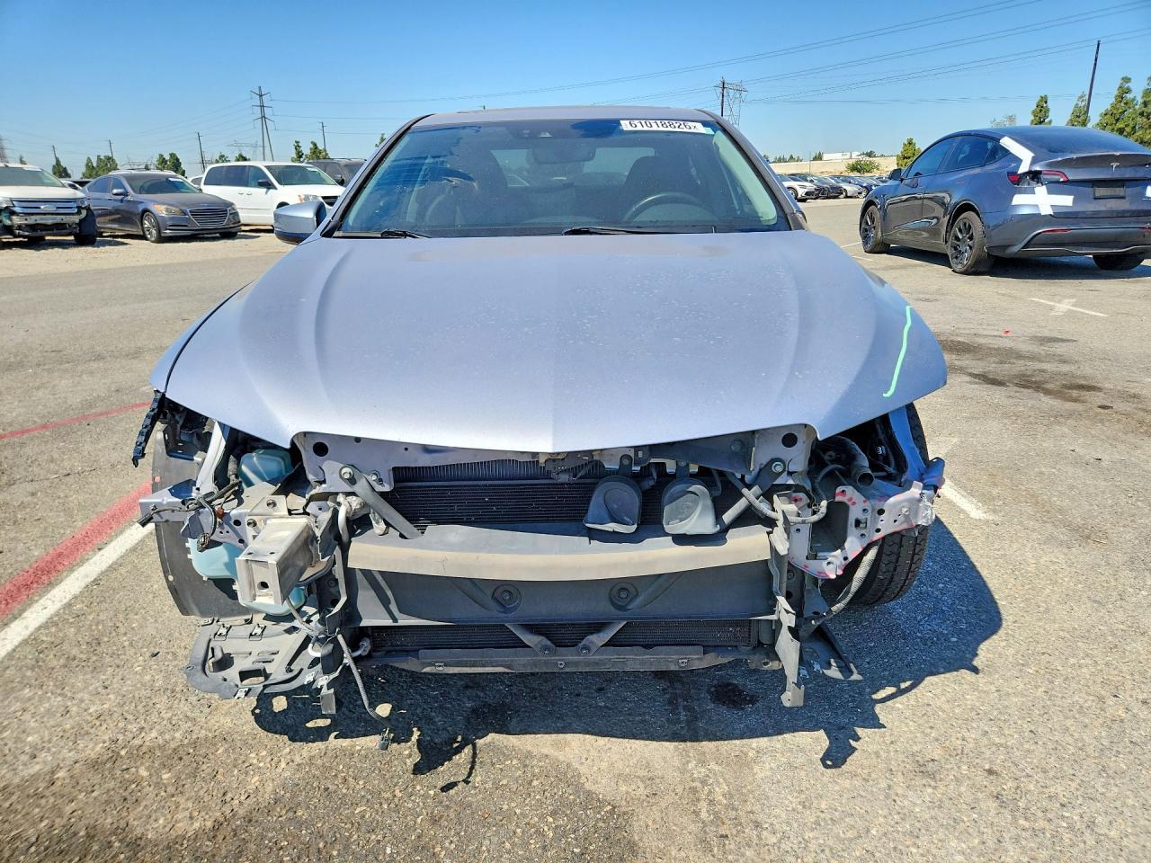 2015 Acura TLX, Tech
