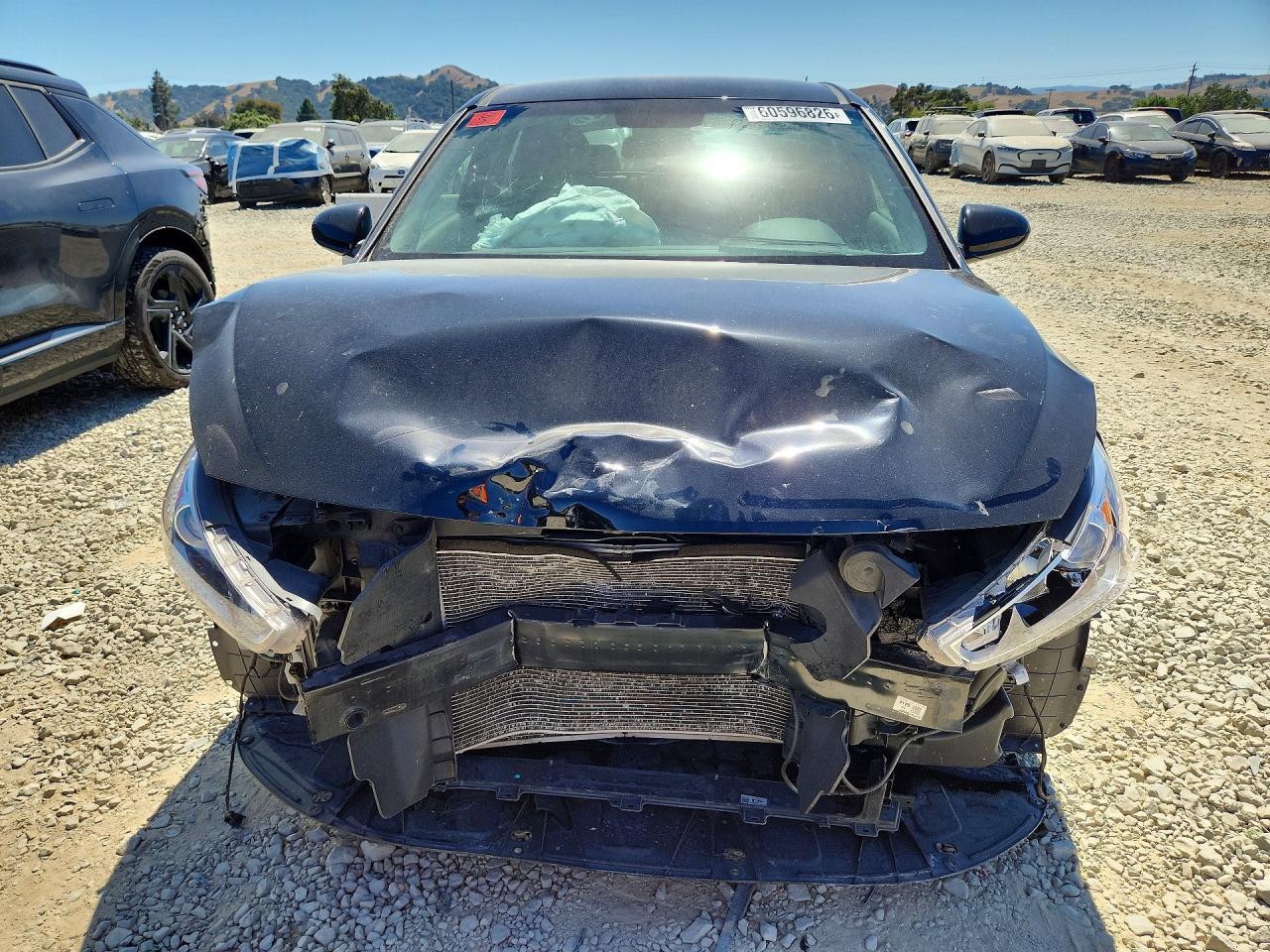 2020 Hyundai Elantra, Base