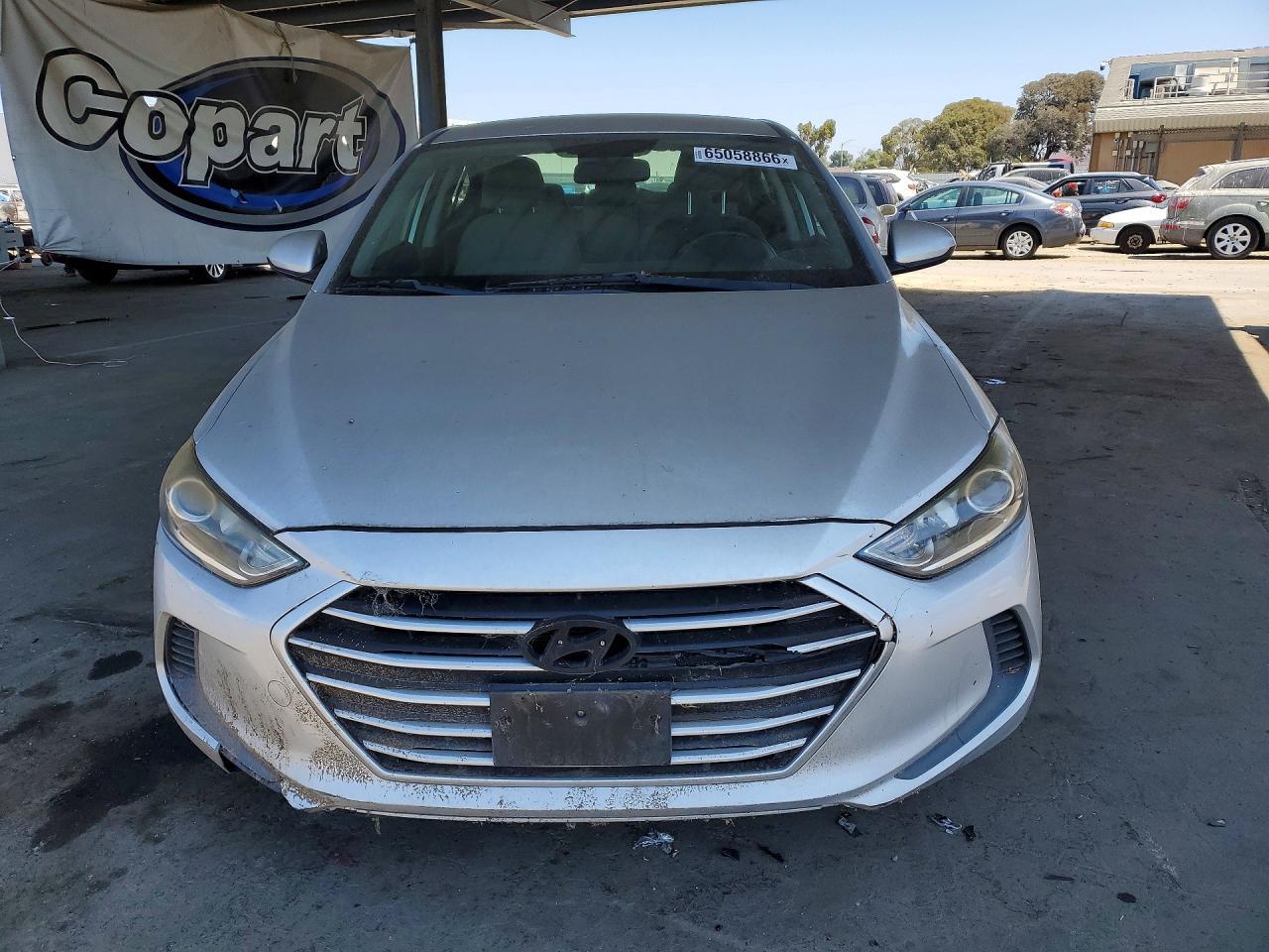 2017 Hyundai Elantra, SE