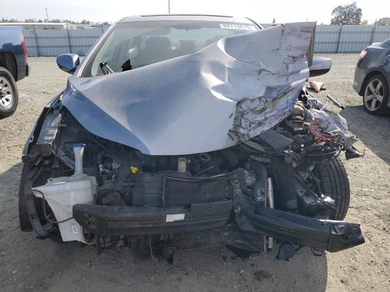 2015 Hyundai Elantra, SE