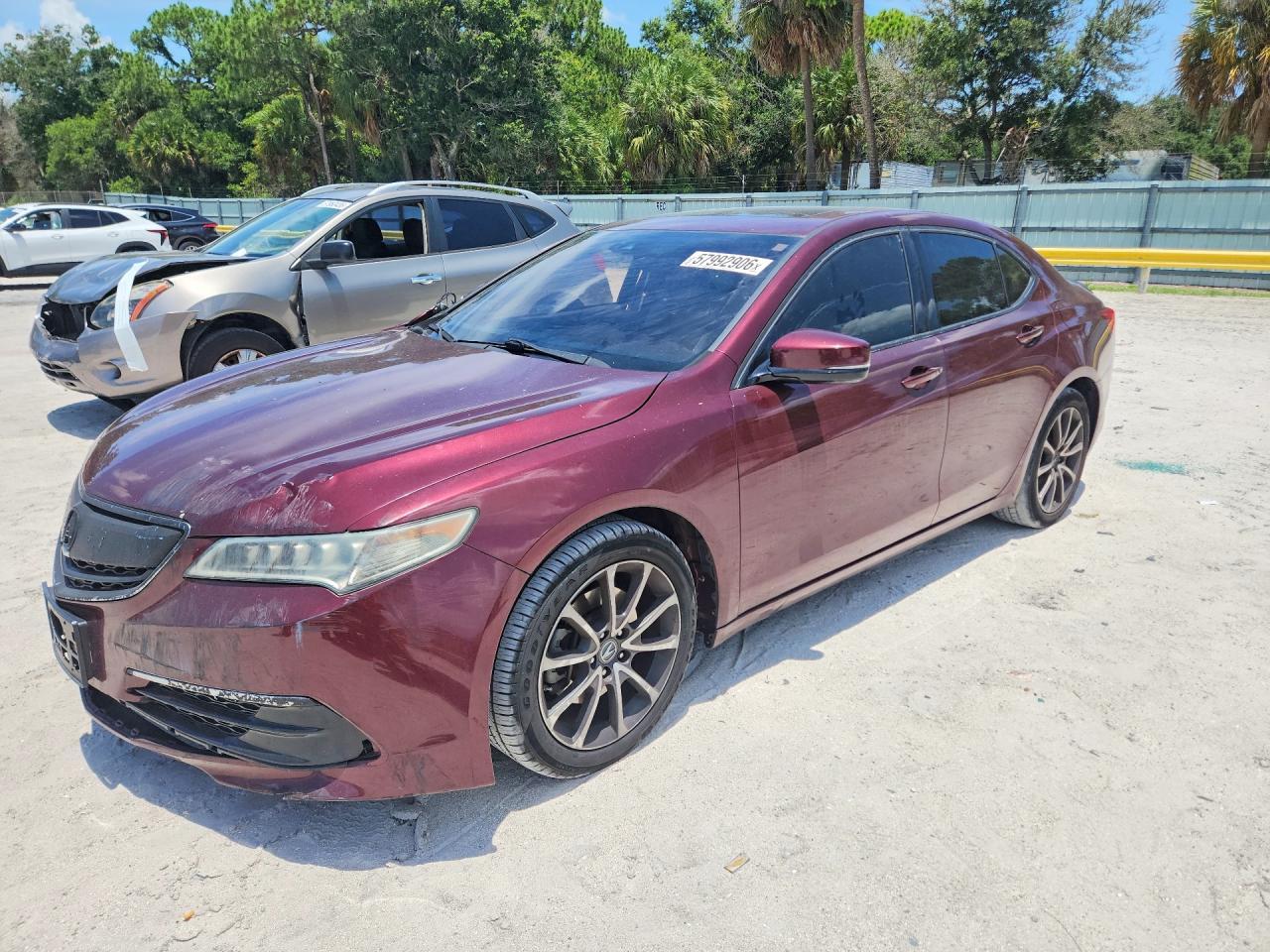 2015 Acura TLX, Tech