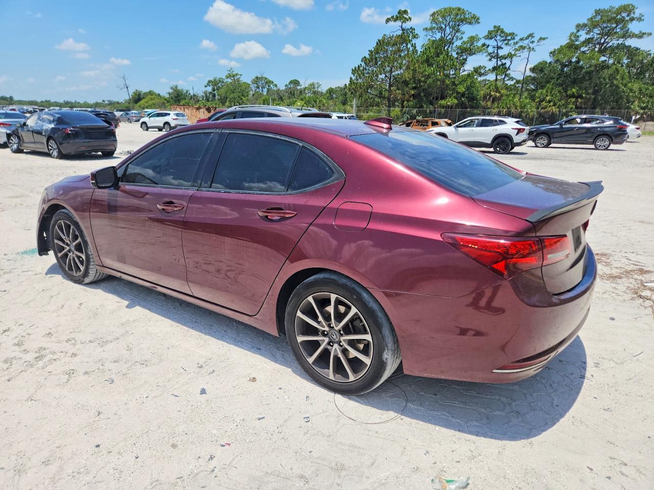 2015 Acura TLX, Tech