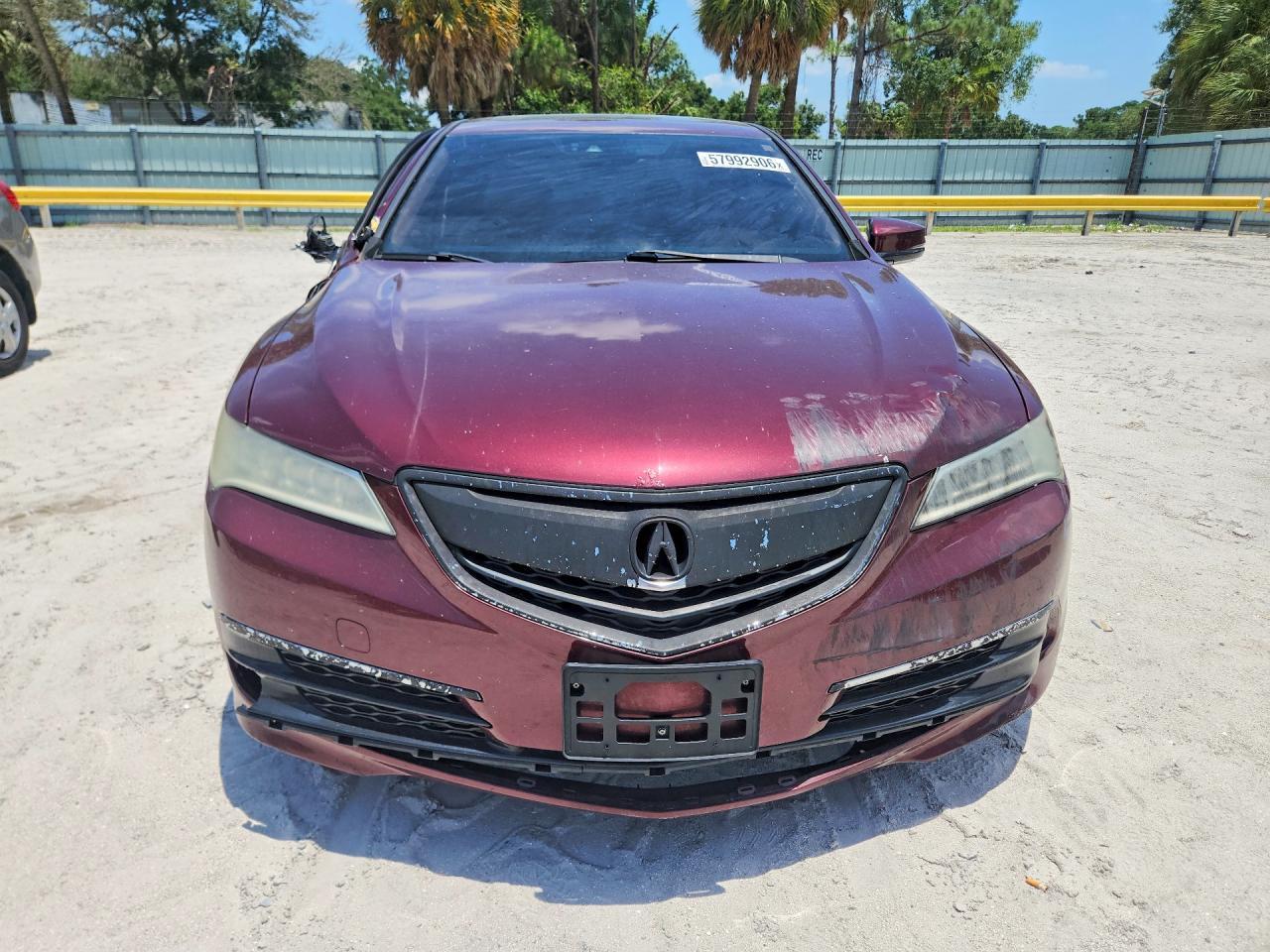 2015 Acura TLX, Tech