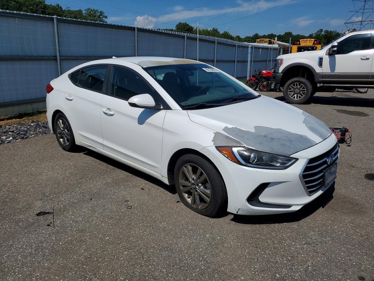 2017 Hyundai Elantra, SE
